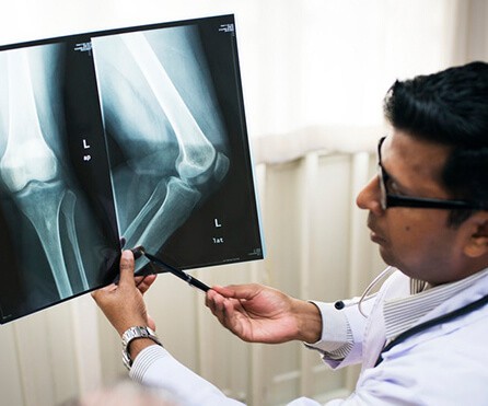 doctor shows patient xray of legs